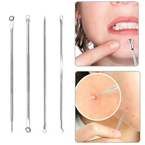4 Pcs Blackhead Acne Removal Set