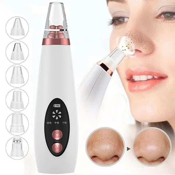 Multi-Funcational Rechargeable Blackhead Remover