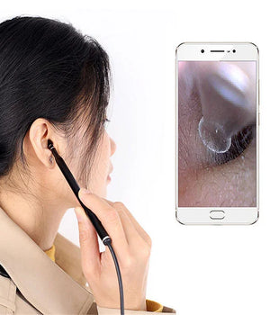 Smart Ear Cleaner With Mini Camera