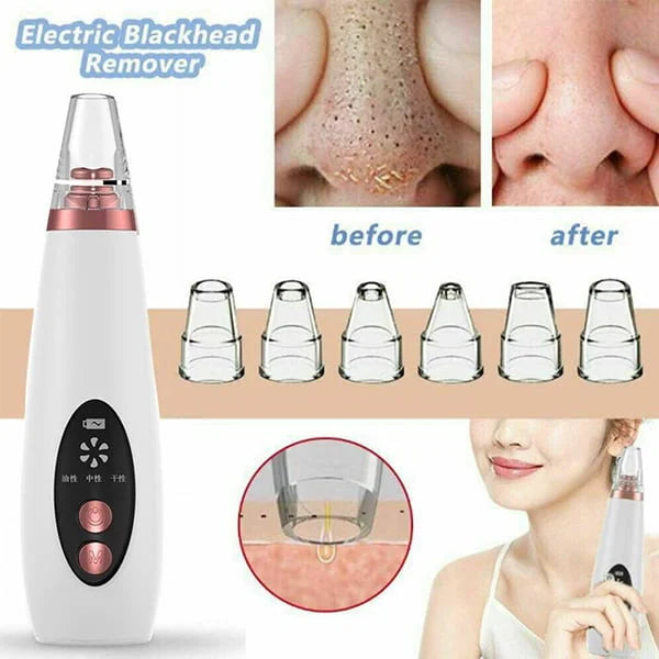 Multi-Funcational Rechargeable Blackhead Remover