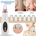 Multi-Funcational Rechargeable Blackhead Remover