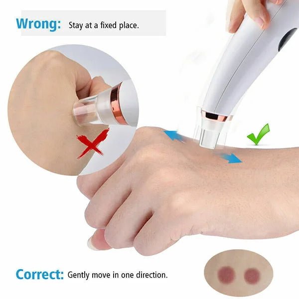 Multi-Funcational Rechargeable Blackhead Remover