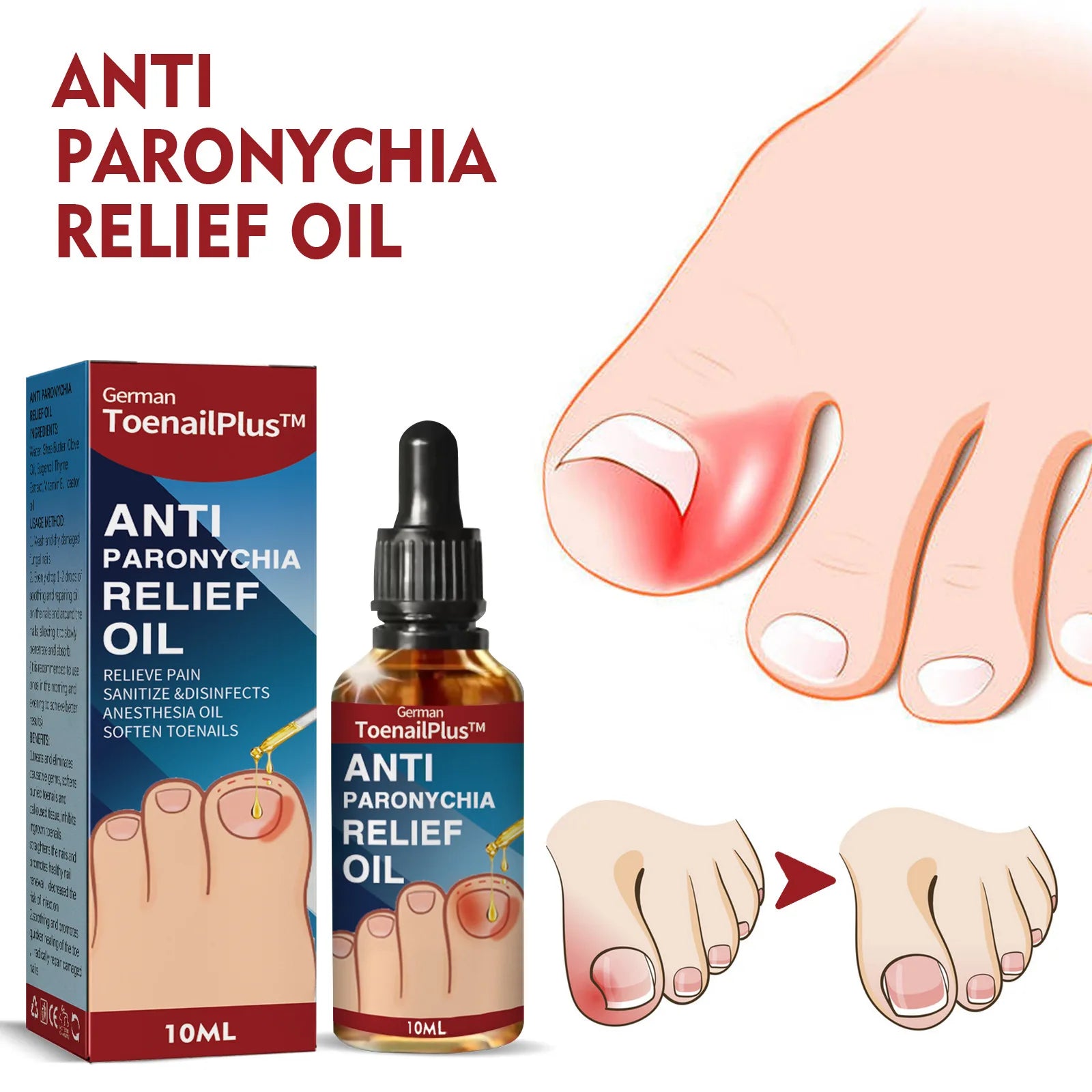 Anti-Fungal Nail Pain Relief Oil