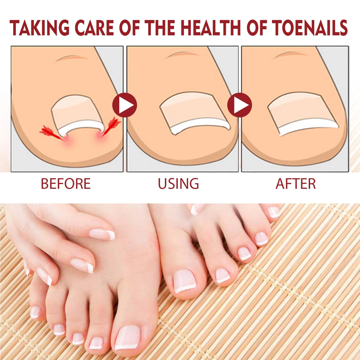 Anti-Fungal Nail Pain Relief Oil