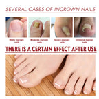 Anti-Fungal Nail Pain Relief Oil