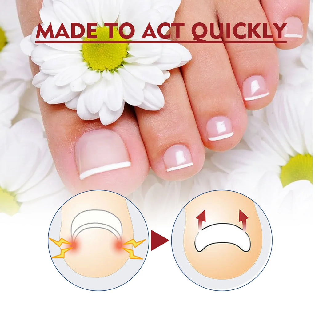 Anti-Fungal Nail Pain Relief Oil