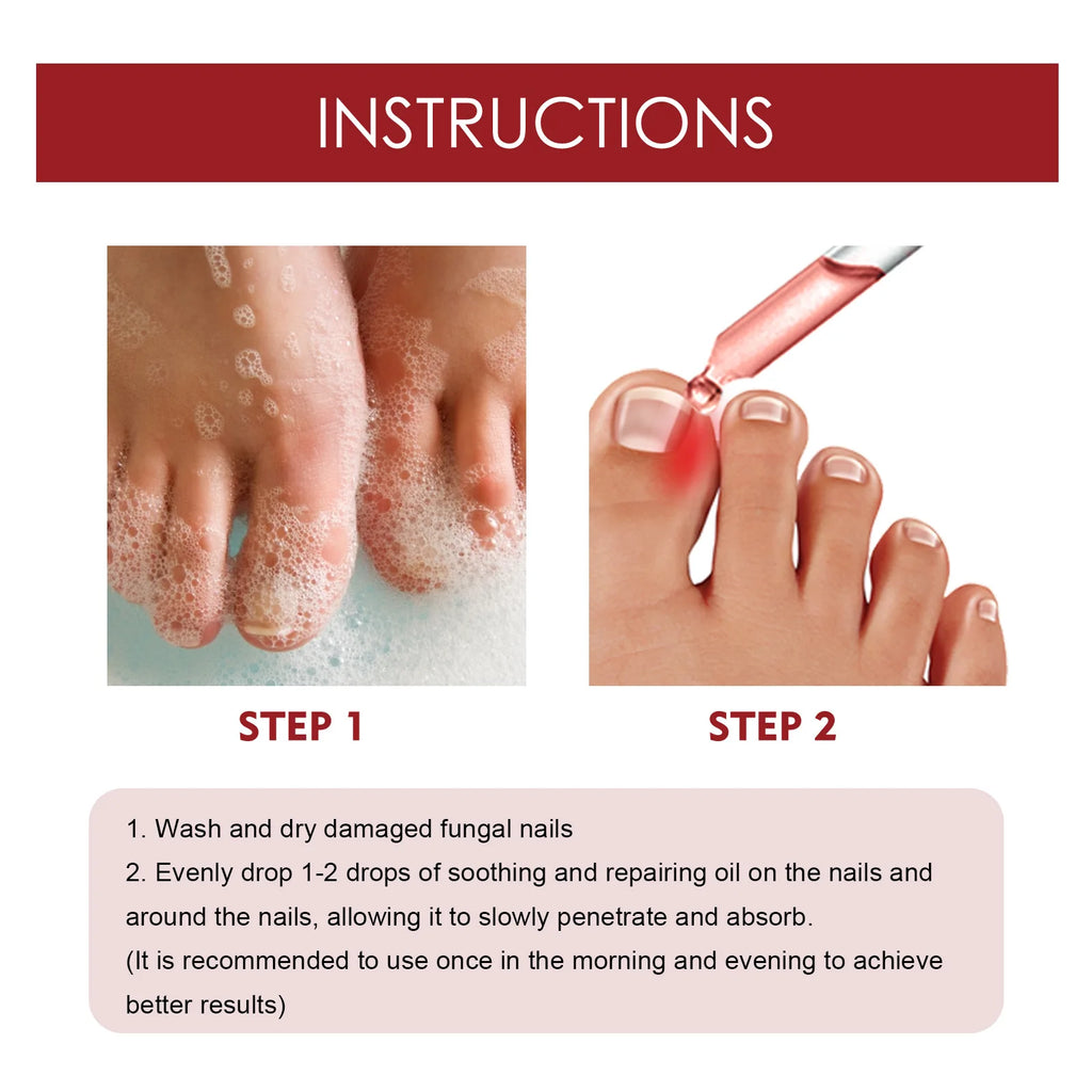 Anti-Fungal Nail Pain Relief Oil