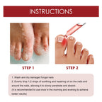 Anti-Fungal Nail Pain Relief Oil