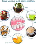 Professional Electric Teeth Whitening Polisher