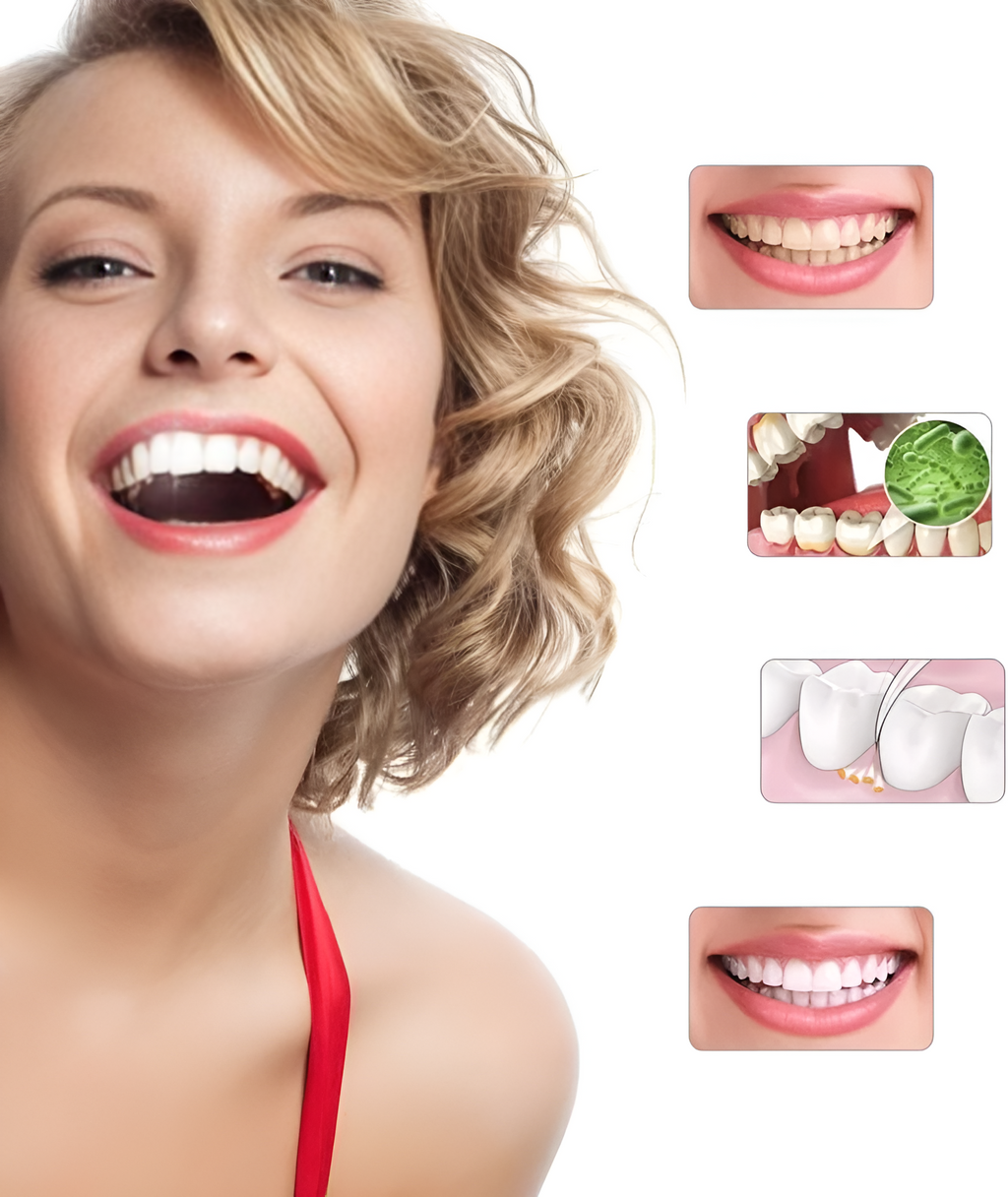 Professional Electric Teeth Whitening Polisher