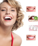 Professional Electric Teeth Whitening Polisher